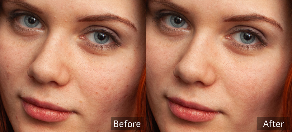 【软件/PS插件】AI智能人像美容修肤美白磨皮软件四件套Retouch4me Heal/Dodge & Burn/Eye Vessel/portraitvolumes 支持Win系统插图(8)
