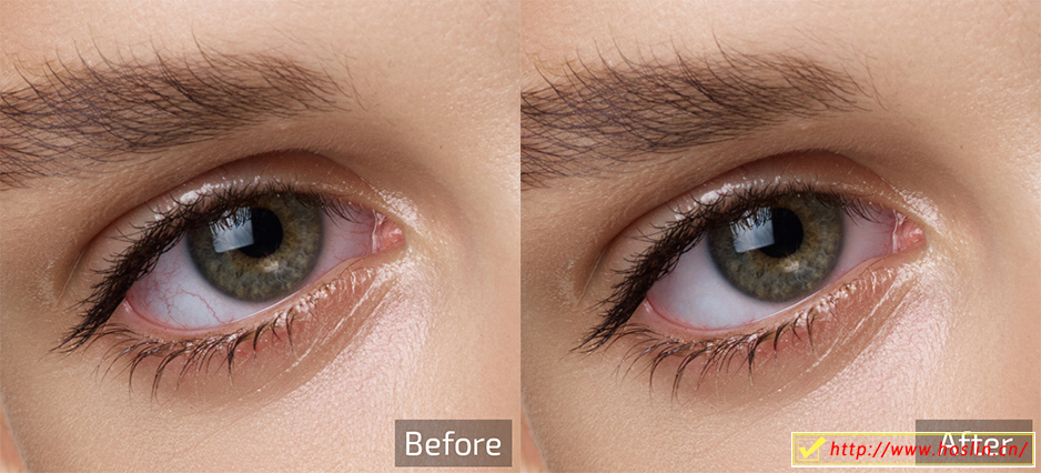 【软件/PS插件】AI智能人像美容修肤美白磨皮软件四件套Retouch4me Heal/Dodge & Burn/Eye Vessel/portraitvolumes 支持Win系统插图(16)